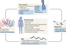 Turner Syndrome: Understanding the Genetic Condition Affecting Women in India