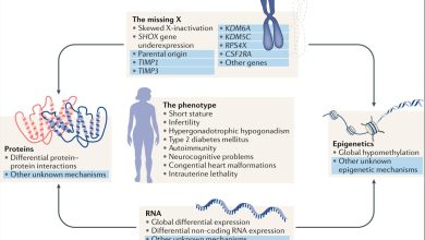 Turner Syndrome: Understanding the Genetic Condition Affecting Women in India